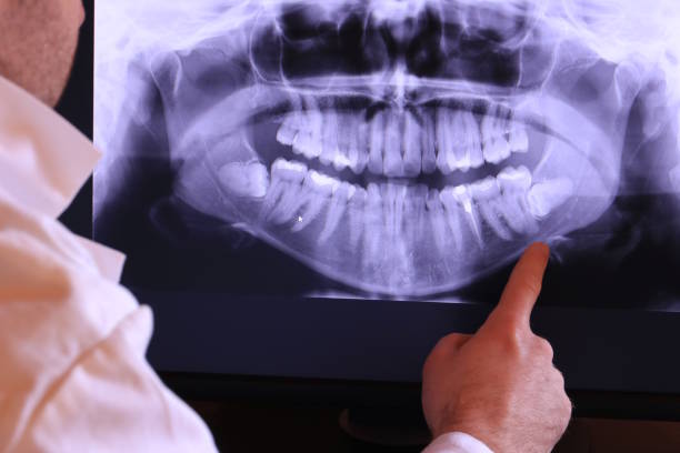 Best Emergency Broken Tooth Repair in Alderson, WV