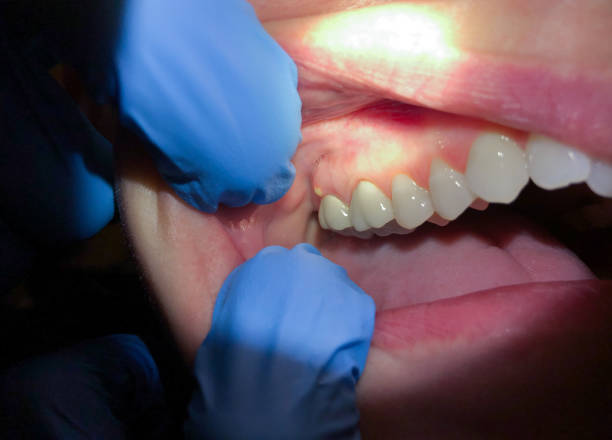 Best After-Hours Emergency Dentist in Alderson, WV