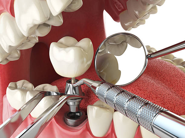 Best After-Hours Emergency Dentist in Alderson, WV