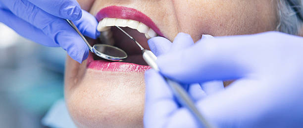 Best Emergency Root Canal Treatment in Alderson, WV